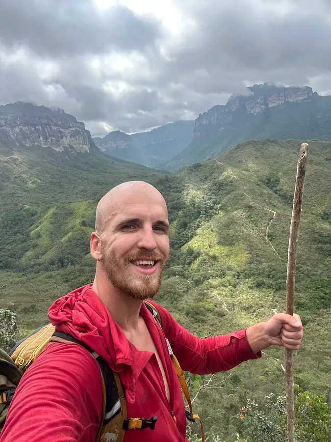 Gandalf without hair